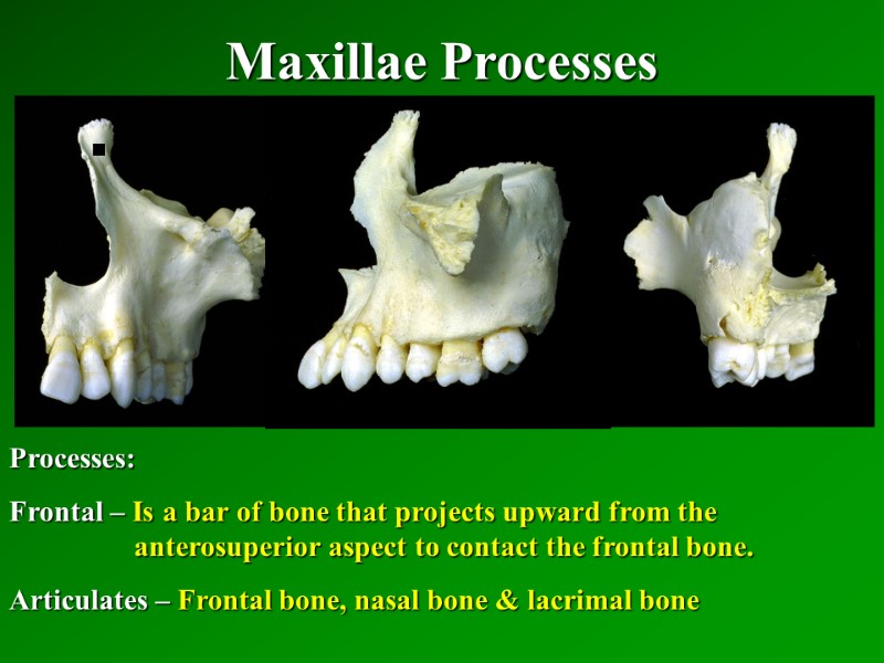 Maxillae Processes   Processes: Frontal – Is a bar of bone that projects